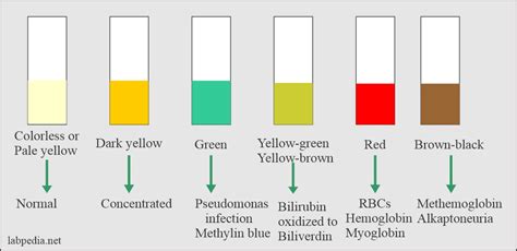 What Normal (and Abnormal) Urine Test Results .